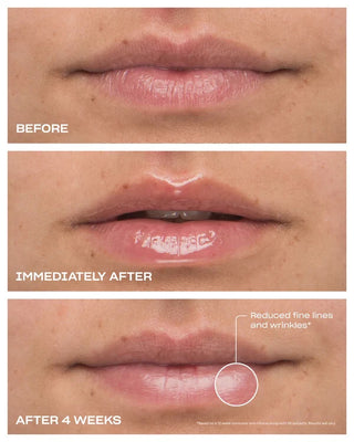 Babe Original Cloud 9 Peptide Lip Serum with Metal Tri-Roll